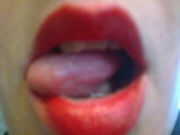 kiss