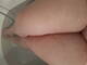 Legs