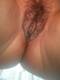 My pus