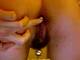 palline anali